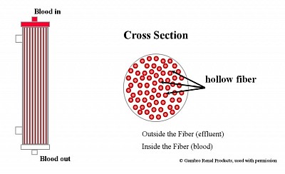 Structure of hemofilter