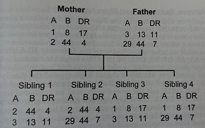 HLA compatibility in first degree relatives.