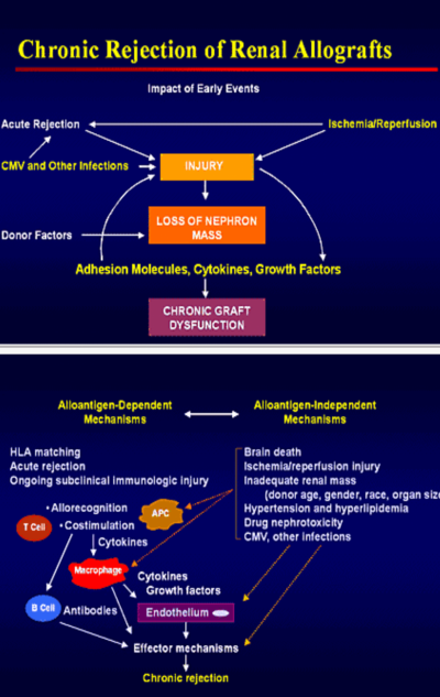 Chronic rejection of allograft.