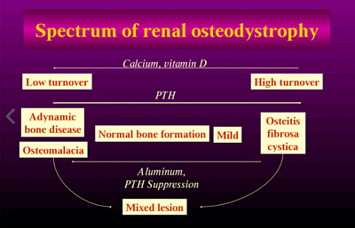 Osteodystrophy
