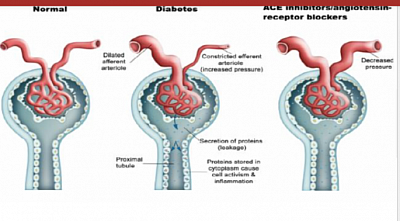 Protect nephron