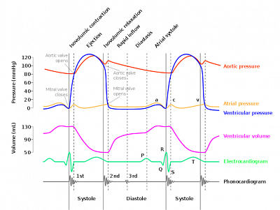 Wiggers diagram