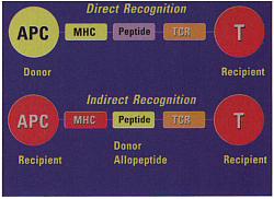 Two pathways  of allorecognition.  APC indicates  antigen presenting  cell; MHC, major  histocompatibility  complex; TCR, T-cell  receptor;T,T cell.  Yellow indicates  donor-derived; red,  recipient.