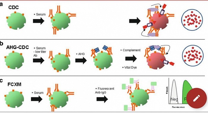 Evolution of basic crossmatching techniques (figure above). ( a) In an unenhanced complement dependent cytotoxicity crossmatch (CD), when high titer DSA is bound to the cell in  suffi cient density, complement is activated, the cell is killed and the vital dye is taken up identifying the dead cells. ( b) With the AHG enhancement, lower titer antibody is less dense on the cell  surface and would not naturally activate complement. Adding AHG increases the overall density  of complement activating antibodies on a cell that already has some DSA bound, thereby allowing  complement activation with subsequent cell death as with CDC alone. ( c) In FCXM, donor-specific antibody binds the cell and a second fluorescent antibody to human IgG is used to detect even small amounts of bound antibody. When run through a flow cytometer, the DSA (which may be  complement or noncomplement binding) is measured as fluorescence on the cells.