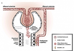 Sepsis results in the release of damage- (DAMPs) and pathogen-associated molecular patterns (PAMPs), which are ﬁltered at the glomeruli. These can lead to microcirculatory dysfunction,