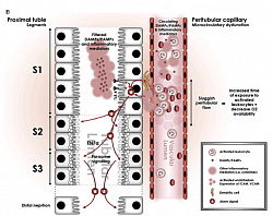 increased oxidative stress, expression of tumor necrosis factor (TNF) receptors in the S2 segment tubular  cells  cell cycle arrest, namely tissue inhibitor of metalloproteinase 2  (TIMP-2)