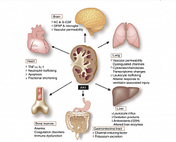 Acute kidney injury (AKI)-induced distant organ effects, including  microvascular inﬂammation and coagulation, cell apoptosis,  transporter activity, oxidative stress, and transcriptional responses.
