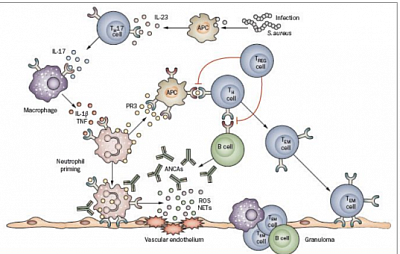 ANCA-mediated neutrophil activation induces the generation of neutrophil extracellular traps (NETs) containing PR3 and MPO. NETs have several pathogenic roles in AAV—they can adhere to the endothelium causing damage, and they might also activate plasmacytoid dendritic cells and B cells to produce interferon and ANCAs, respectively