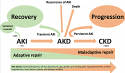 [A] After Acute Kidney Injury, the kidney has the ability to repair itself. With mild injury this repair can result in the return to a structural and functional state that is indistinguishable from normal. However, when the injury is more severe or is superimposed on baseline kidney abnormalities, the repair process can lead to fibrosis, which can facilitate progression to chronic kidney disease. Epidemiological studies now show that patients who have had AKI, have a marked increase in their risk for the development of end-stage renal disease.